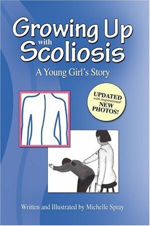 Growing Up with Scoliosis by Michelle Spray