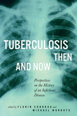 Tuberculosis Then and Now: Perspectives on the History of an Infectious Disease by Michael Worboys, Flurin Condrau