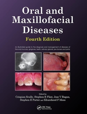 Oral and Maxillofacial Diseases, Fourth Edition by Crispian Scully, Stephen Flint