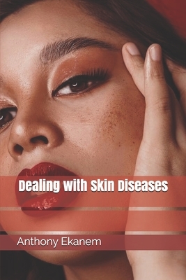 Dealing with Skin Diseases by Anthony Ekanem