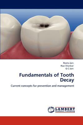 Fundamentals of Tooth Decay by Reeta Jain, G. C, Ravi Shankar