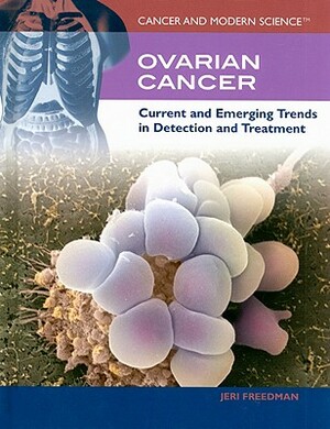 Ovarian Cancer: Current and Emerging Trends in Detection and Treatment by Jeri Freedman