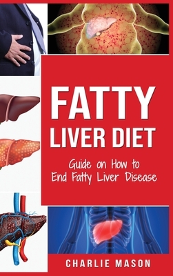 Fatty Liver Diet: Guide on How to End Fatty Liver Disease Fatty Liver Diet Books: Fatty Liver Diet by Charlie Mason