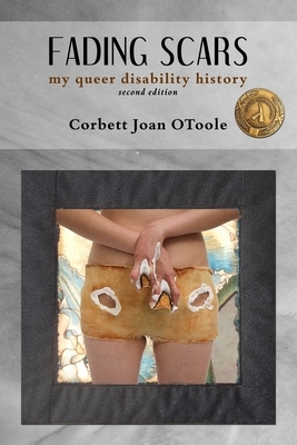 Fading Scars: My Queer Disability History, 2nd Edition by Corbett Joan Otoole