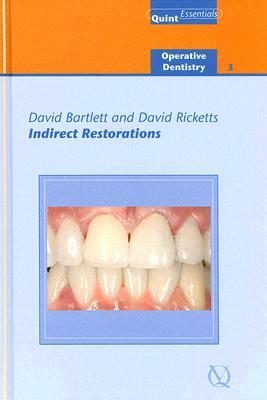 Indirect Restorations by David Ricketts, David Bartlett