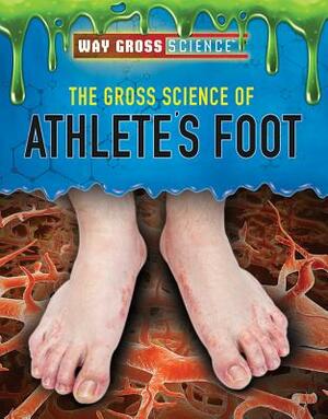 The Gross Science of Athlete's Foot by Mary-Lane Kamberg