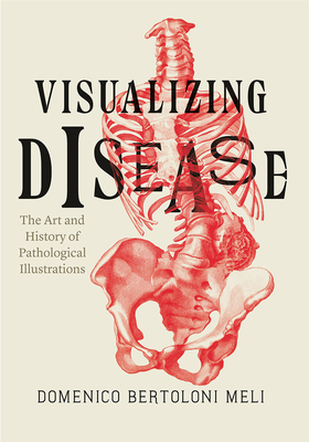 Visualizing Disease: The Art and History of Pathological Illustrations by Domenico Bertoloni Meli