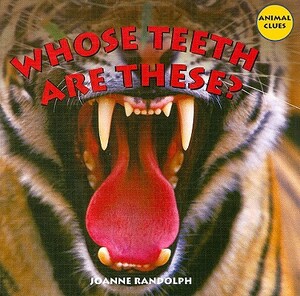 Whose Teeth Are These? by Joanne Randolph