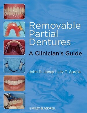 Removable Partial Dentures: A Clinician's Guide by John D. Jones, Lily T. Garcia