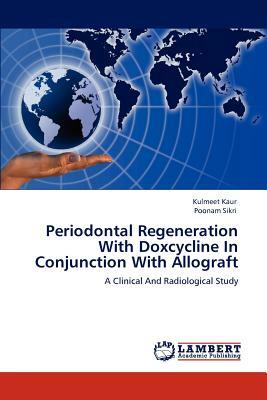 Periodontal Regeneration with Doxcycline in Conjunction with Allograft by Kulmeet Kaur, Poonam Sikri