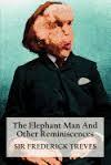 The Elephant Man and Other Reminiscences by Frederick Treves