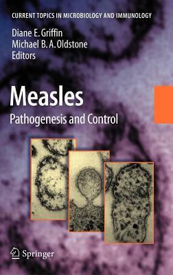 Measles: Pathogenesis and Control by 