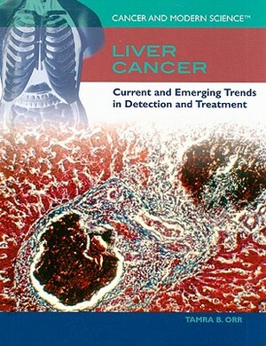 Liver Cancer: Current and Emerging Trends in Detection and Treatment by Tamra B. Orr