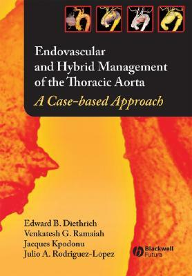 Endovascular and Hybrid Management of the Thoracic Aorta: A Case-Based Approach by Jacques Kpodonu, Venkatesh Ramaiah, Edward B. Diethrich