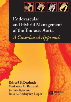 Endovascular and Hybrid Management of the Thoracic Aorta: A Case-Based Approach by Venkatesh Ramaiah, Edward B. Diethrich, Jacques Kpodonu