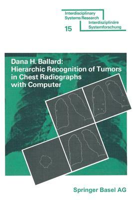 Hierarchic Recognition of Tumors in Chest Radiographs with Computer by Ballard