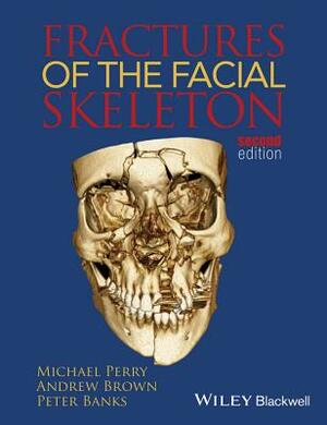 Fractures of the Facial Skeleton by Peter Banks, Michael Perry, Andrew Brown