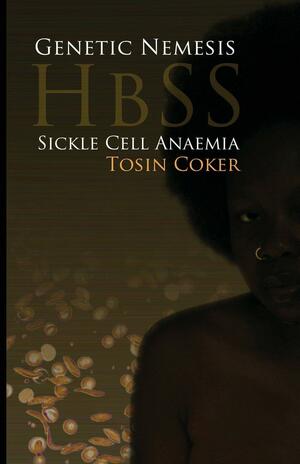 Genetic Nemesis HbSS: Sickle Cell Anaemia by Tosin Coker