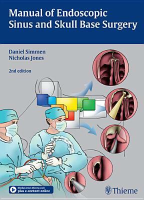 Manual of Endoscopic Sinus and Skull Base Surgery by Daniel Simmen, Nick Jones, Klinik Hirslanden Orl-Zentrum