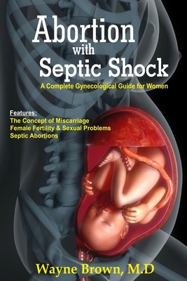 Abortion with Septic Shock: A Complete Gynecological Guide for Women by Ifiokobong Ene, Wayne Brown M. D.