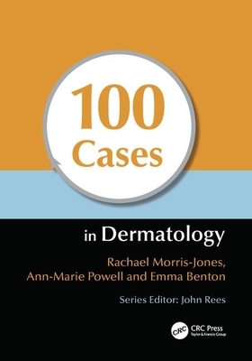 100 Cases in Dermatology by Rachael Morris-Jones, Ann-Marie Powell, Emma Benton
