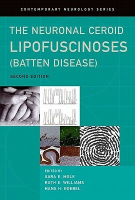 The Neuronal Ceroid Lipofuscinoses (Batten Disease) by Ruth Williams, Hans Goebel, Sara Mole