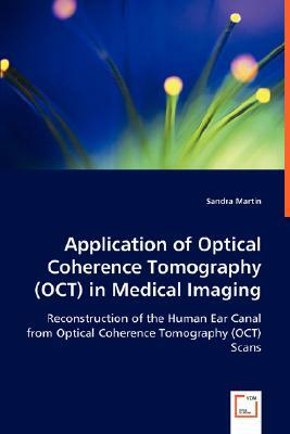 Application of Optical Coherence Tomography (Oct) in Medical Imaging by Sandra Martin