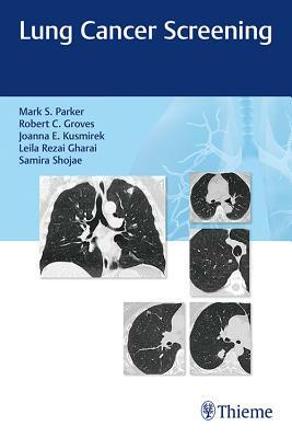 Lung Cancer Screening by Joanna Kusmirek, Robert Groves, Mark Parker