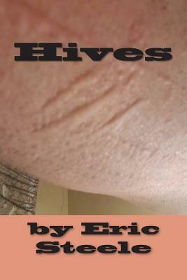 Hives by Eric Steele