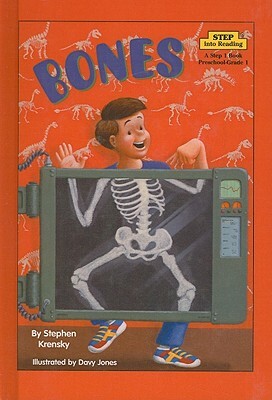 Bones by Stephen Krensky