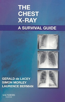 The Chest X-Ray: A Survival Guide by Simon Morley, Laurence Berman, Gerald de Lacey