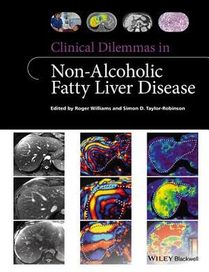 Clinical Dilemmas in Non-Alcoholic Fatty Liver Disease by Simon D. Taylor-Robinson, Roger Williams