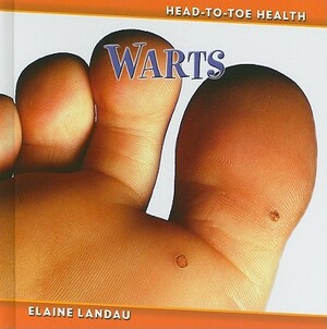 Warts by Elaine Landau