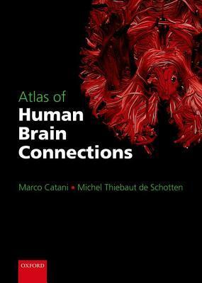 Atlas of Human Brain Connections by Michel Thiebaut de Schotten, Marco Catani