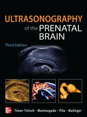 Ultrasonography of the Prenatal Brain by Ana Monteagudo, Gianluigi Pilu, Ilan Timor-Tritsch