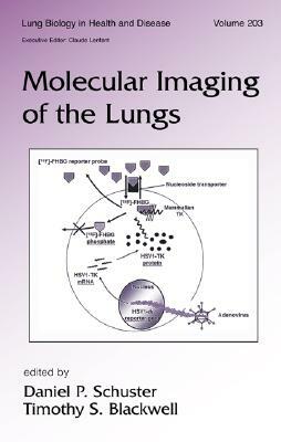 Molecular Imaging of the Lungs by 