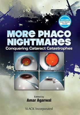 More Phaco Nightmares: Conquering Cataract Catastrophes by Amar Agarwal