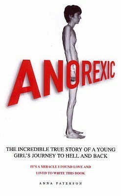 Anorexic by Anna Paterson