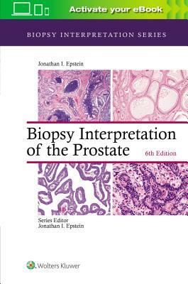 Biopsy Interpretation of the Prostate by Jonathan I. Epstein
