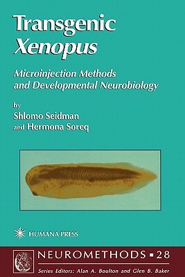 Transgenic Xenopus: Microinjection Methods and Developmental Neurobiology by Shlomo Seidman, Hermona Soreq