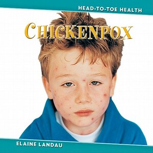 Chickenpox by Elaine Landau