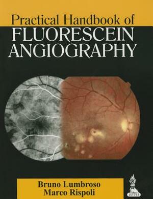 Practical Handbook of Fluorescein Angiography by Marco Rispoli, Bruno Lumbroso