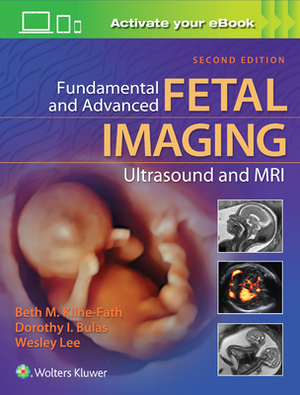 Fundamental and Advanced Fetal Imaging Ultrasound and MRI by Beth Kline-Fath, Dorothy Bulas, Wesley Lee