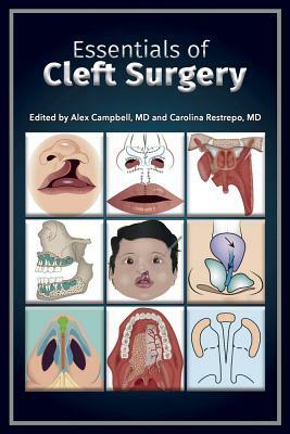 Essentials of Cleft Surgery by Alex Campbell