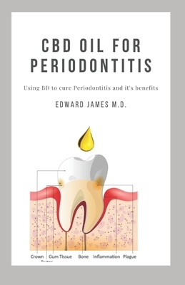 CBD Oil for Periodontitis: Using CBD to Cure Periodontitis and It's Benefits by Edward James