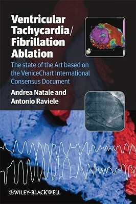 Ventricular Tachycardia / Fibrillation Ablation: The State of the Art Based on the Venicechart International Consensus Document by Antonio Raviele, Andrea Natale