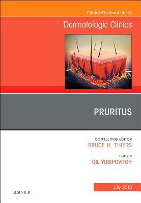 Pruritus, an Issue of Dermatologic Clinics, Volume 36-3 by Gil Yosipovitch