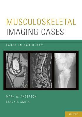 Musculoskeletal Imaging Cases by Mark W. Anderson, Stacy E. Smith