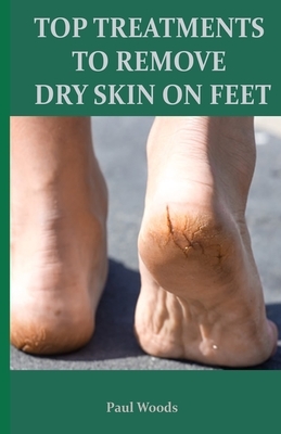 Top Treatments to Remove Dry Skin on Feet by Paul Woods