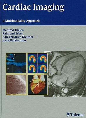 Cardiac Imaging: A Multimodality Approach by Manfred Thelen, Karl-Friedrich Kreitner, Raimund Erbel